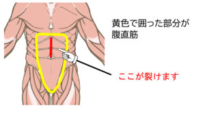 腹直筋の説明