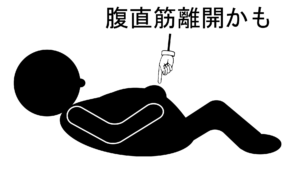 腹直筋離開かも