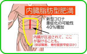 内臓脂肪型肥満、腹直筋のイラスト